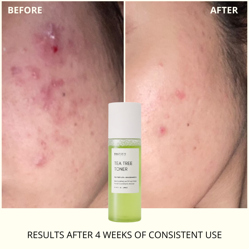TEA TREE TONER