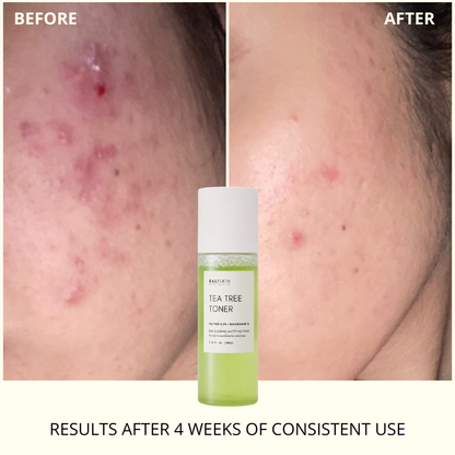 TEA TREE TONER - Skin Clearing Mattifying Toner